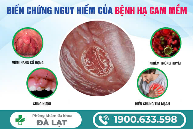 Hình ảnh minh họa